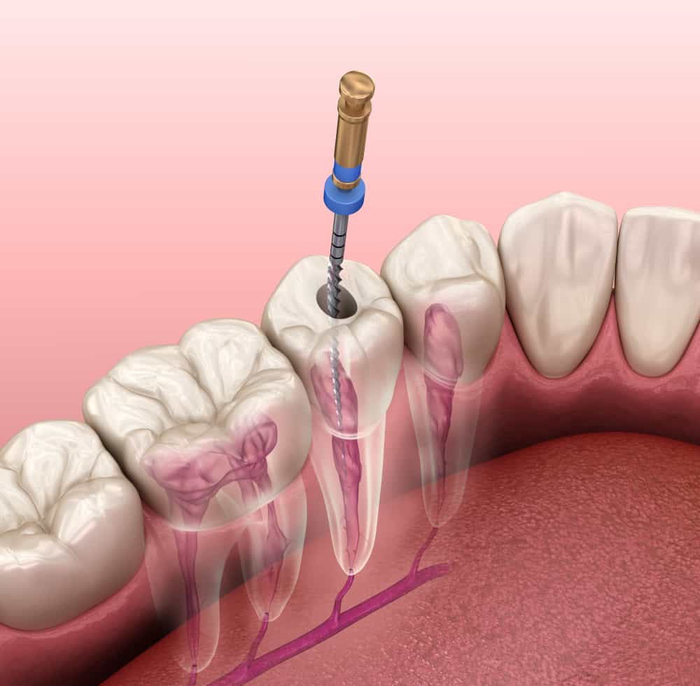 Dentofacial orthopedics/Aligners 2